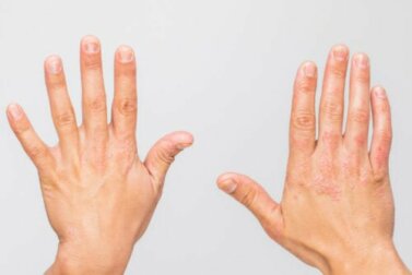Doenças autoinflamatórias
