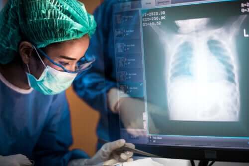 Transplante de pulmão: tudo que você precisa saber