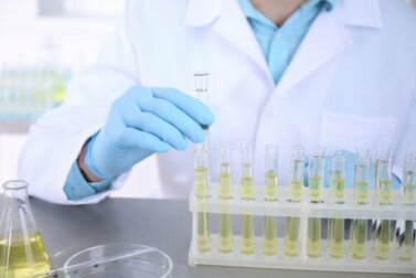 Urocultura: o que é e para que serve?