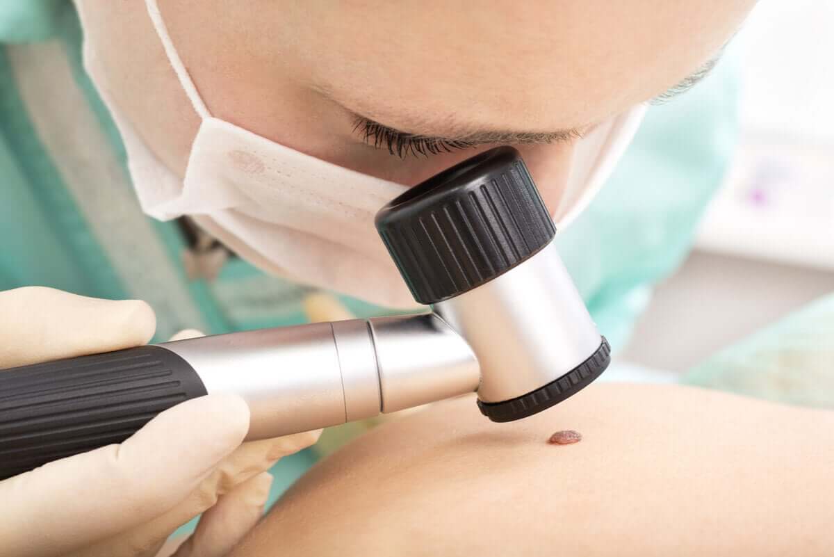 Médico analisando pinta