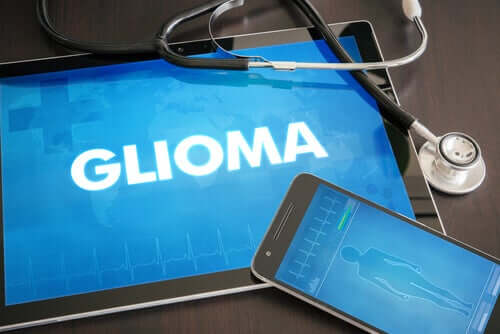 O que é um glioma?