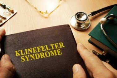 O que é a síndrome de Klinefelter e como afeta os homens?