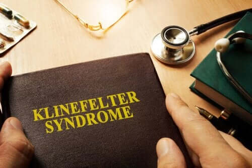 O que é a síndrome de Klinefelter e como afeta os homens?
