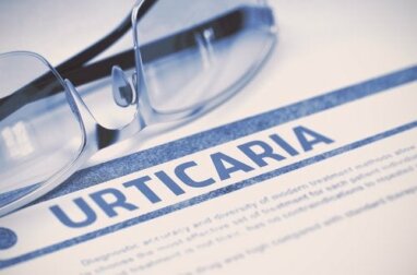 Urticária ao frio: fatores de risco e prevenção