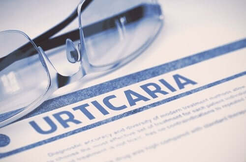 Urticária ao frio: fatores de risco e prevenção