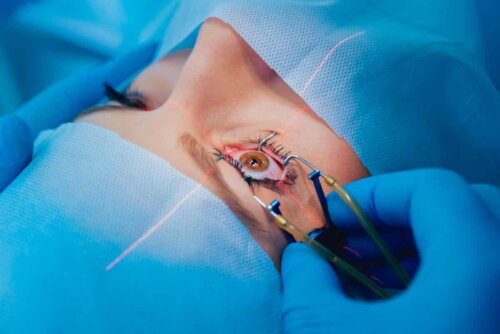 Cirurgia ocular