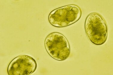 O que é a estrongiloidíase e como é a contaminação?