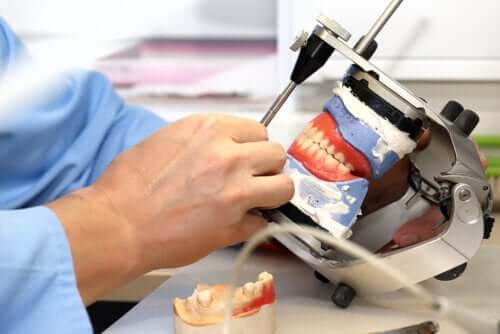 Próteses sobre implantes dentários: o que são e que tipos existem?