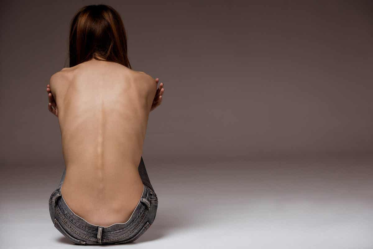 Jovem com anorexia