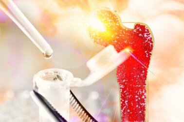 Aplasia medular: tudo que você precisa saber