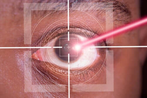 LASIK: vantagens e desvantagens da cirurgia ocular a laser