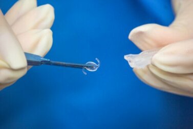 Cirurgia de lente intraocular: quando é necessária?