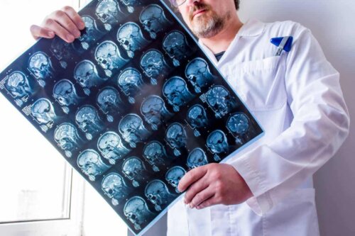 Tomografia computadorizada do cérebro