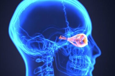 O que é a neuromielite óptica ou doença de Devic?