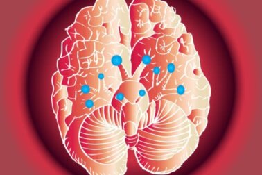 As funções dos 12 nervos cranianos