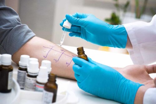 Testes de alergia