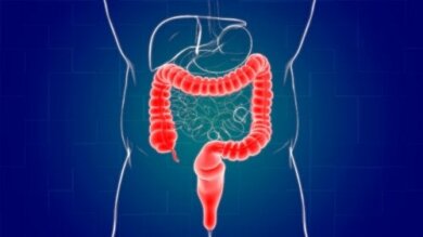 O que é a proctite, o que a causa e como é tratada?