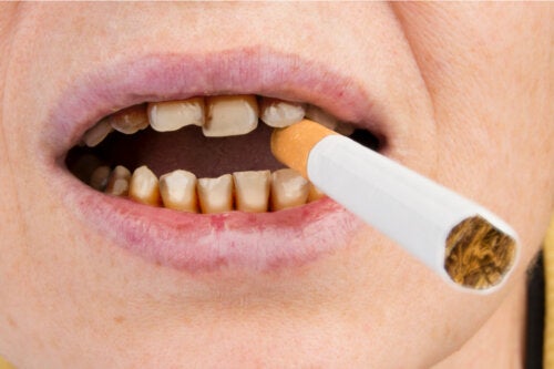 Como o tabaco afeta a saúde dos dentes?