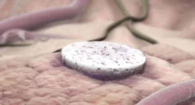 Vacina de Harvard: uma terapia promissora contra o câncer de mama