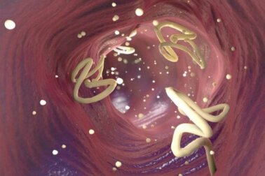 Alho e sementes de abóbora para eliminar parasitas intestinais