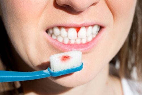 7 dicas para prevenir a periodontite