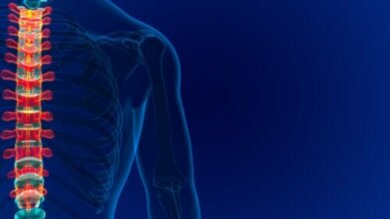 O que é um angioma vertebral? Causas, sintomas e tratamento