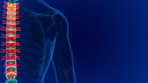 O que é um angioma vertebral? Causas, sintomas e tratamento