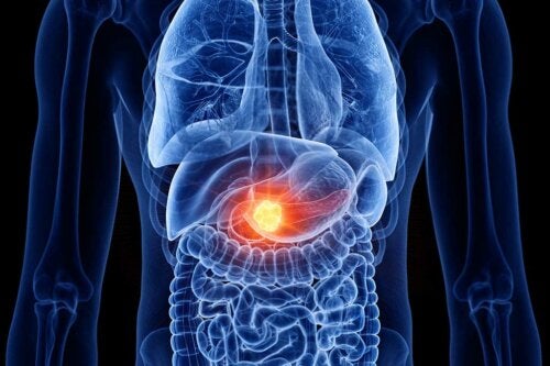 Pancreatite: qual é a dieta mais adequada?