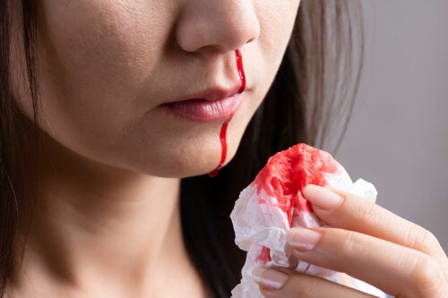 Seu nariz sangra com frequência? Descubra o motivo