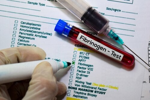 Teste de fibrinogênio no sangue: funções e resultados