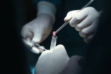 As 6 diferenças entre tumor e câncer