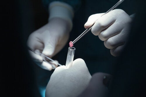 As 6 diferenças entre tumor e câncer