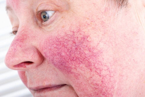 15 doenças de pele comuns e como tratá-las