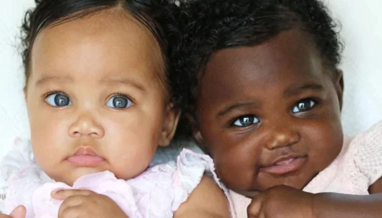 Há 5 anos nasciam as gêmeas com peles diferentes que até hoje encantam a todos