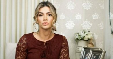 Kelly Key desabafa sobre preconceito sofrido por ter psoríase: "Acham que é contagioso"