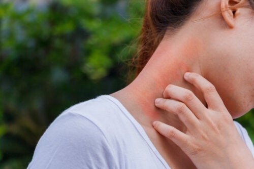 Quais são os tratamentos para a dermatite atópica?