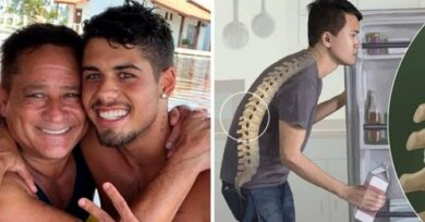 Espondilite anquilosante: conheça a doença incurável que atingiu o filho do cantor Leonardo