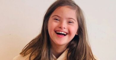 Aos 9 anos, menina com síndrome de Down vira modelo de grife famosa