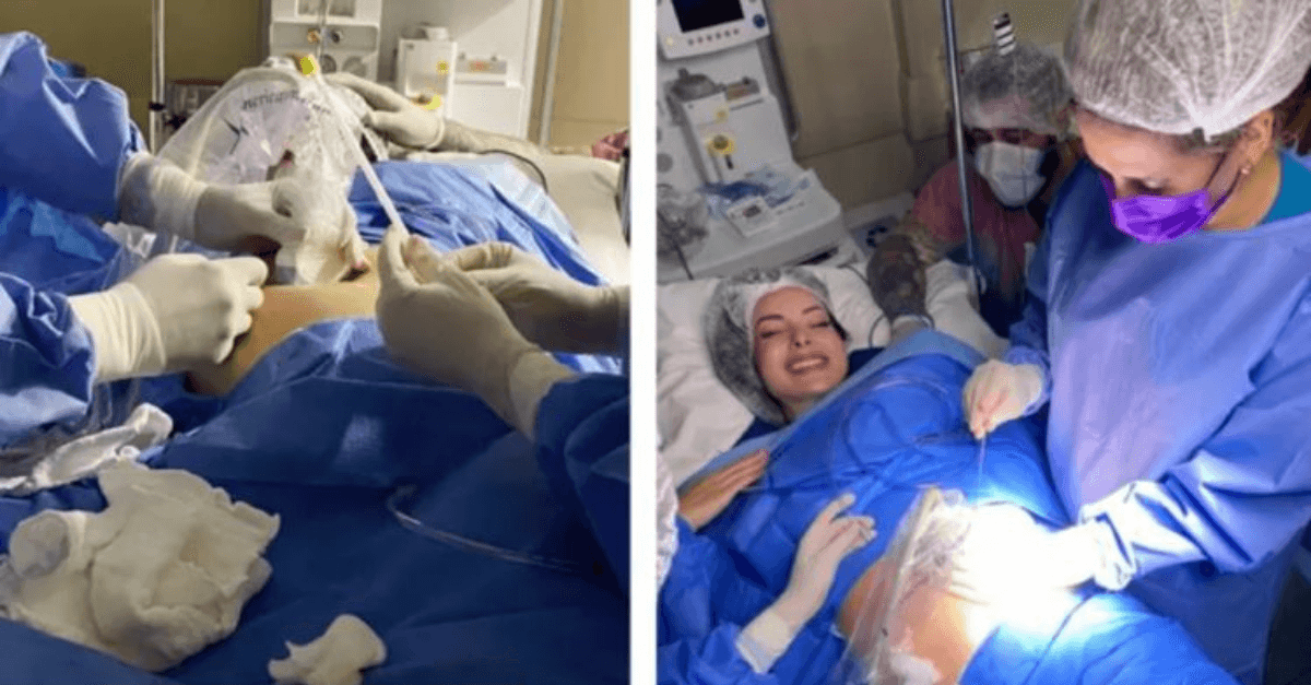 médica cauteriza tumor de bebê