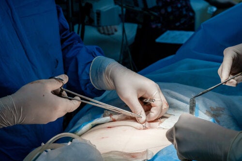 Enxerto de pele: quando usar?