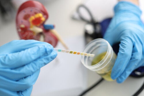 Bacteriúria assintomática: causas comuns e como tratá-la