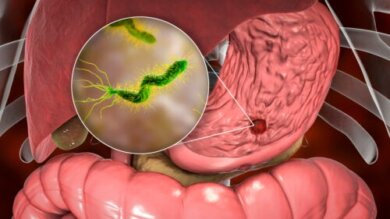 Teste da urease: procedimento, resultados e outras questões