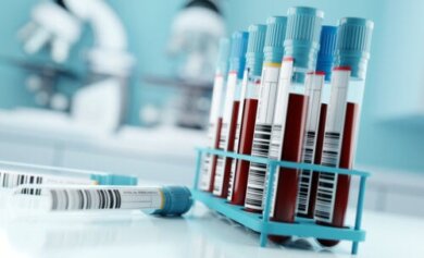 Exame de proteína total: resultados e seu significado