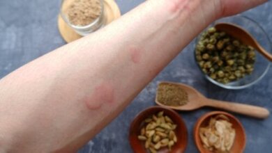 Alergia a especiarias: como identificar?