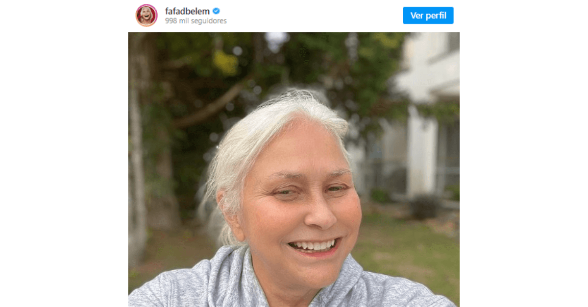 As famosas que assumiram os cabelos brancos