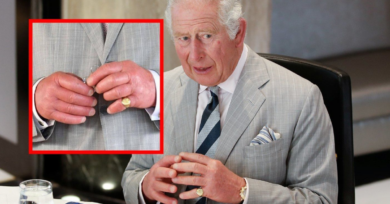 Veja possíveis causas das mãos inchadas de Charles III