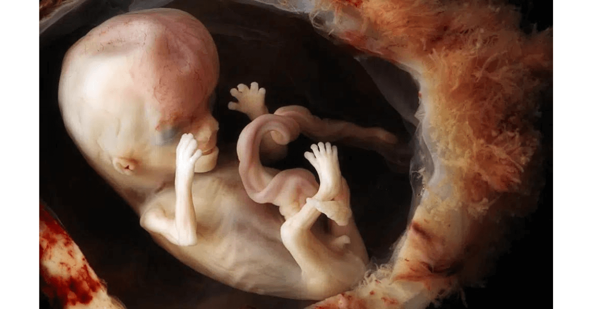Você sabe para onde vão o xixi e o cocô do bebê quando ele está na barriga da mãe?