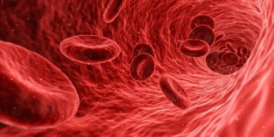 Aneurisma da aorta: tudo o que você precisa saber