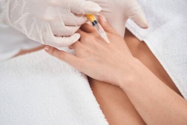 Rejuvenescimento das mãos: quais são as técnicas recomendadas?