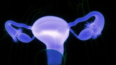 Cistos dermoides ovarianos: sintomas e quando consultar um médico